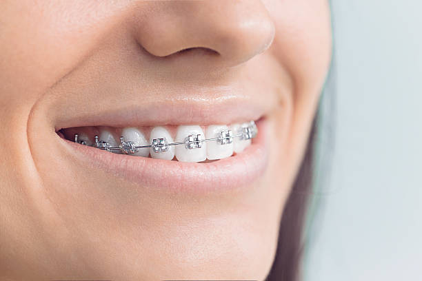 Best Dental Fillings (Composite and Amalgam)  in Highland Beach, FL